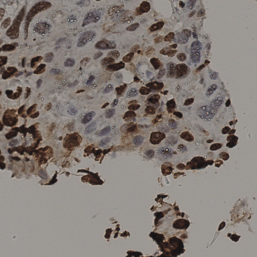 slice_16_56_x14336_y50176.png