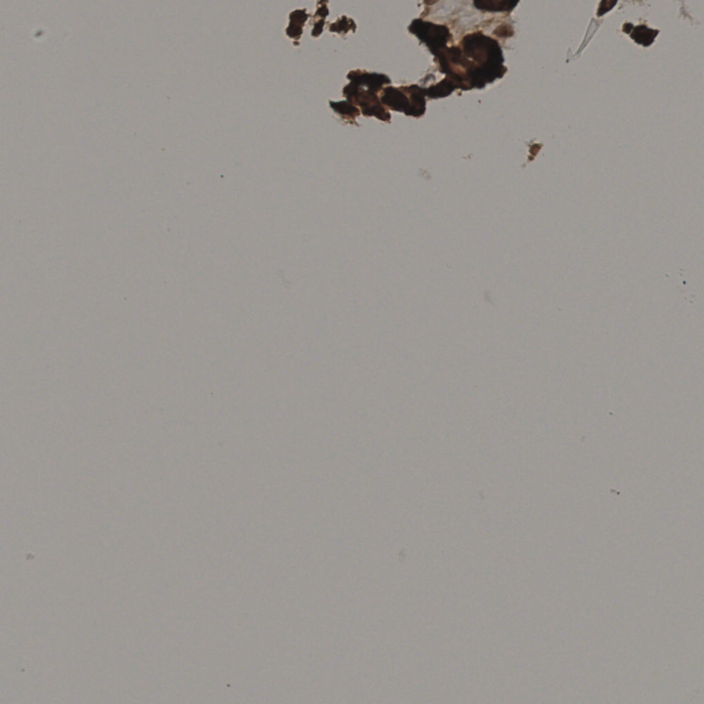 slice_16_57_x14336_y51072.png