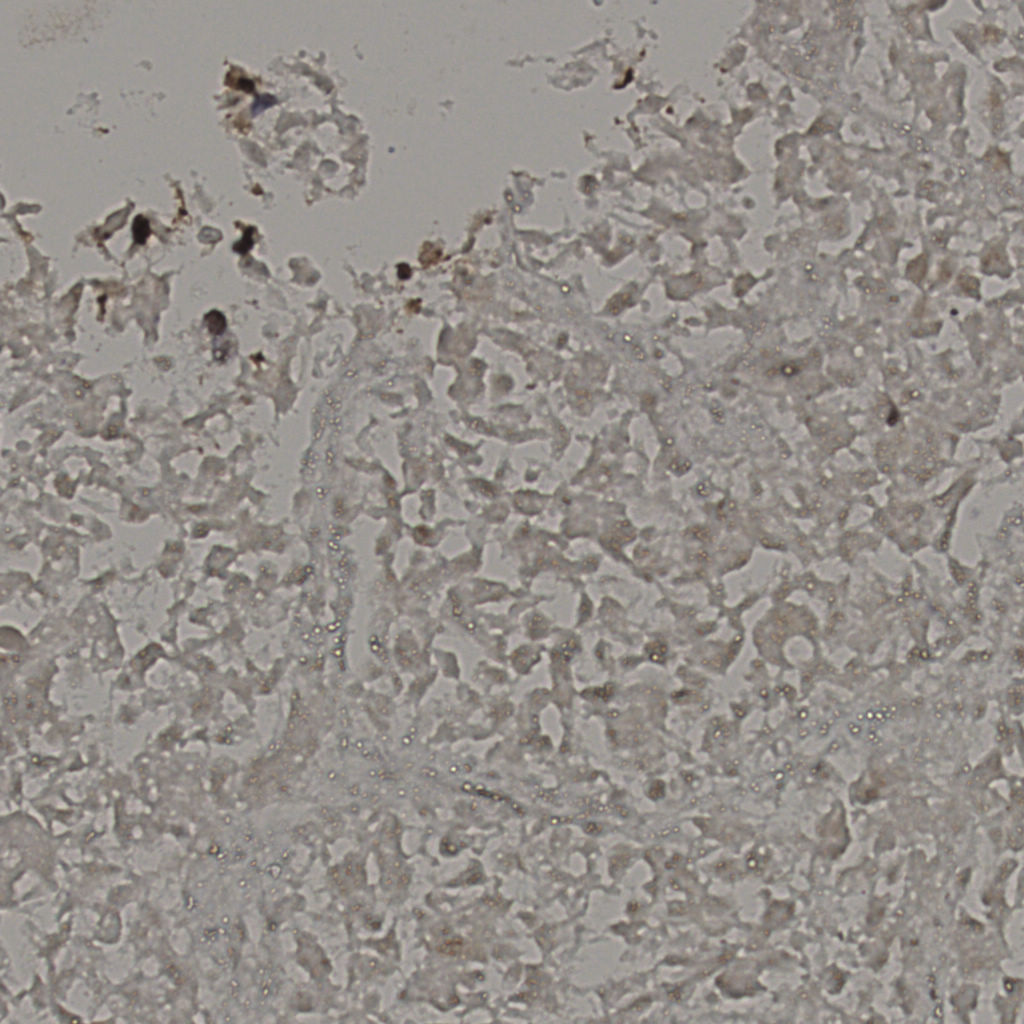 slice_17_38_x15232_y34048.png