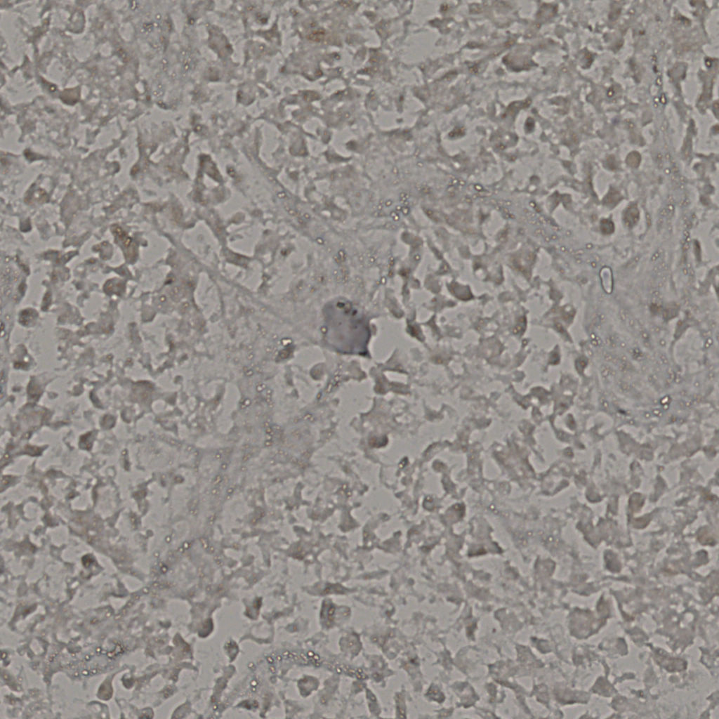 slice_17_39_x15232_y34944.png
