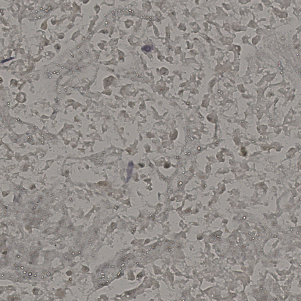 slice_17_40_x15232_y35840.png