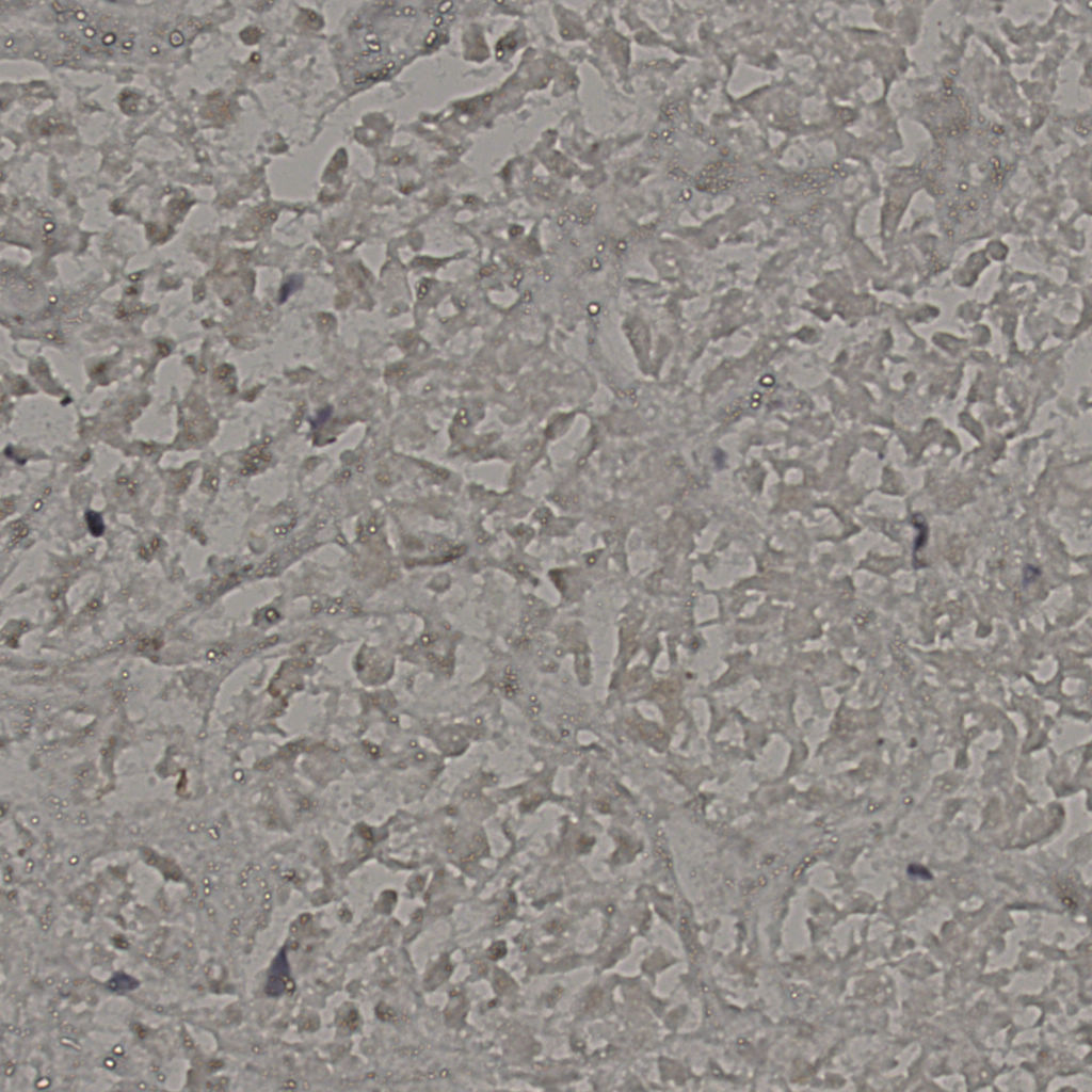 slice_17_41_x15232_y36736.png