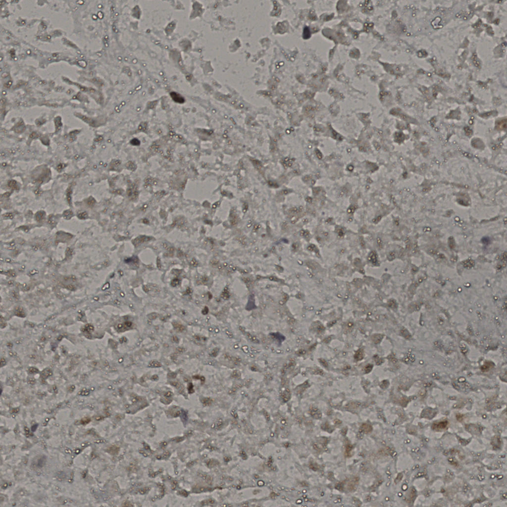 slice_17_48_x15232_y43008.png