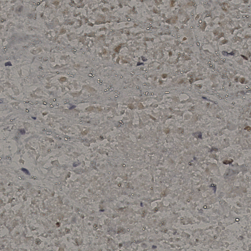slice_17_49_x15232_y43904.png