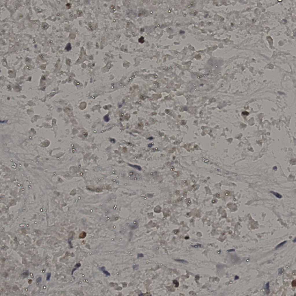 slice_17_50_x15232_y44800.png