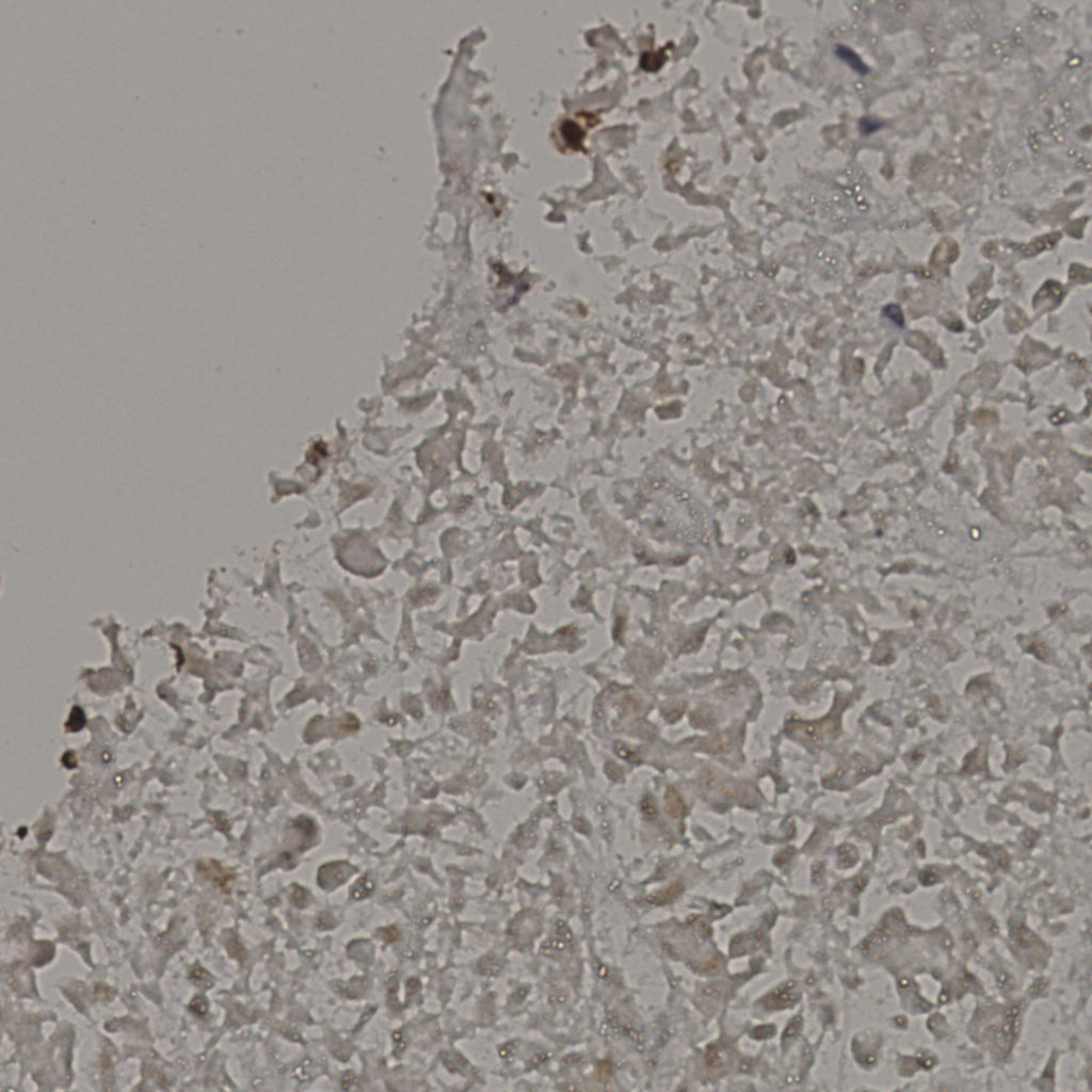 slice_18_37_x16128_y33152.png