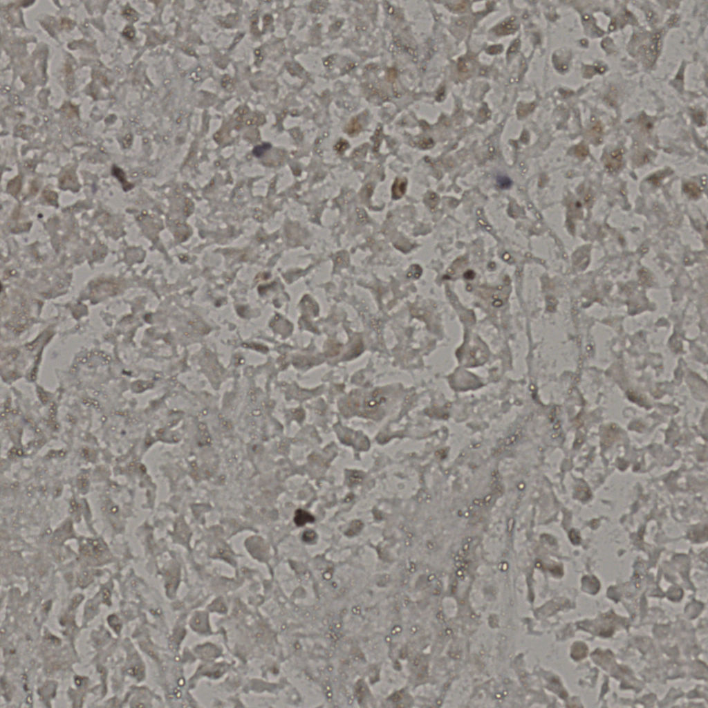 slice_18_38_x16128_y34048.png