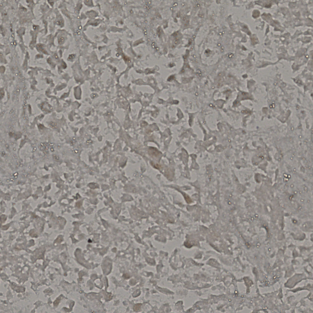 slice_18_39_x16128_y34944.png