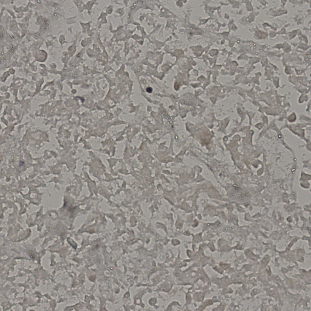 slice_18_41_x16128_y36736.png