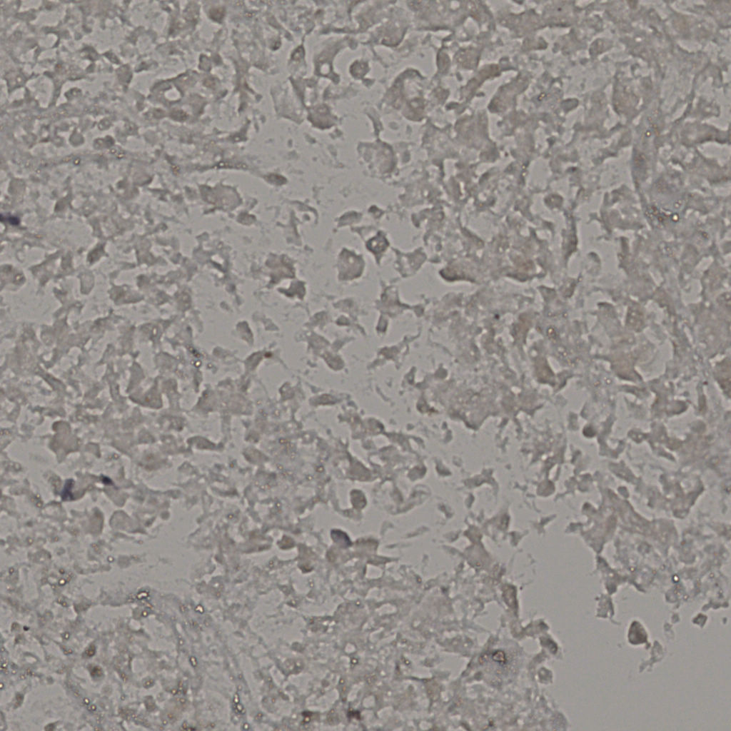slice_18_42_x16128_y37632.png