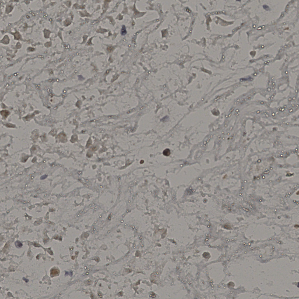 slice_18_45_x16128_y40320.png