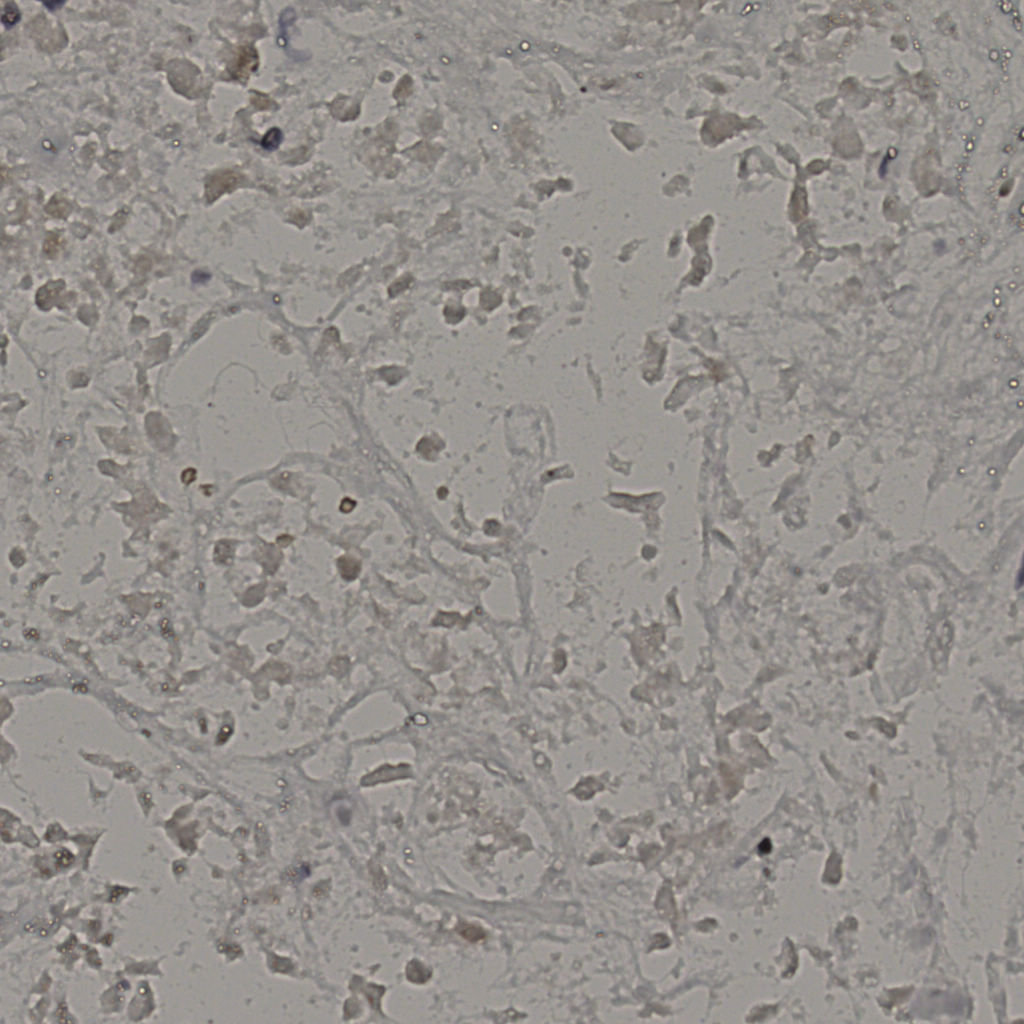 slice_18_47_x16128_y42112.png