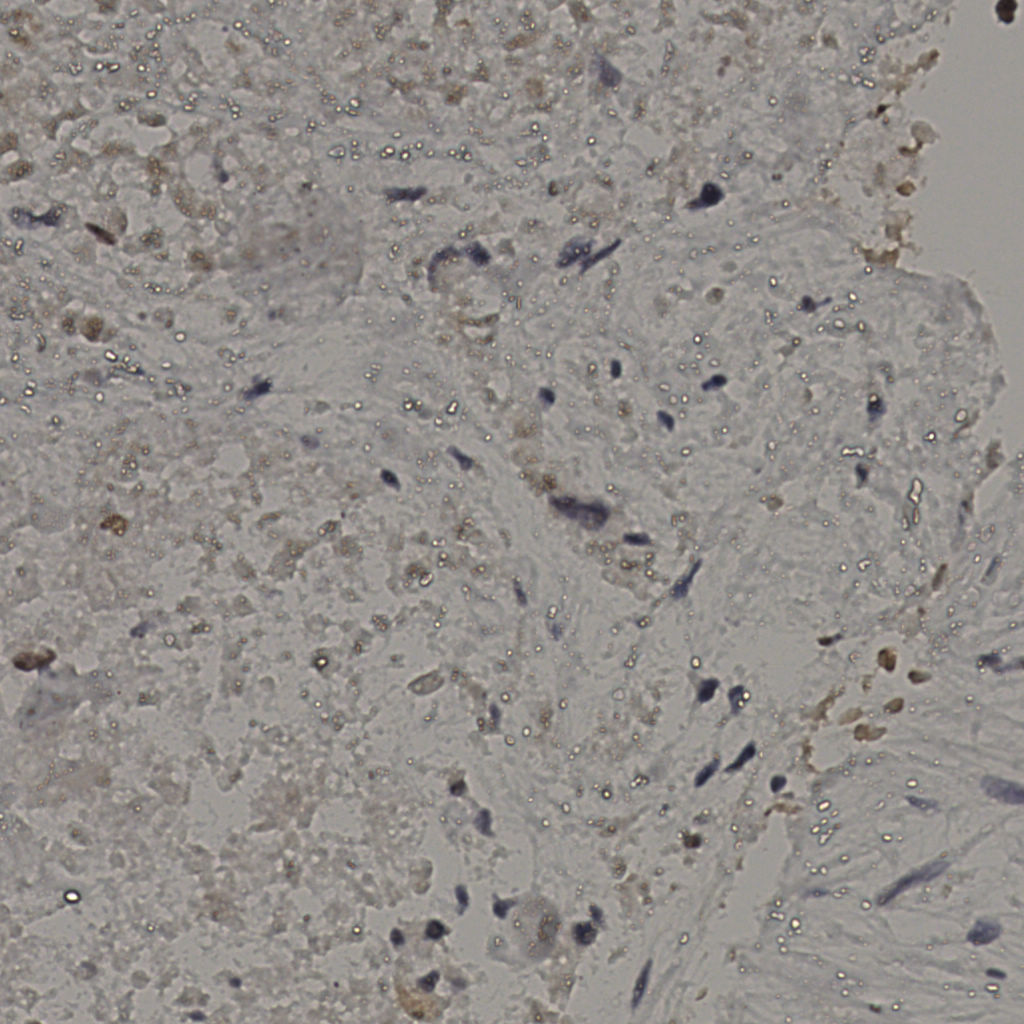 slice_18_49_x16128_y43904.png