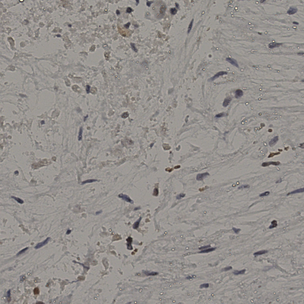 slice_18_50_x16128_y44800.png