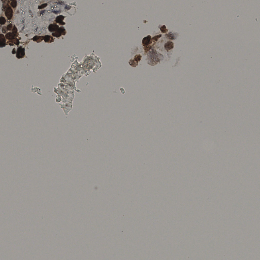 slice_18_57_x16128_y51072.png