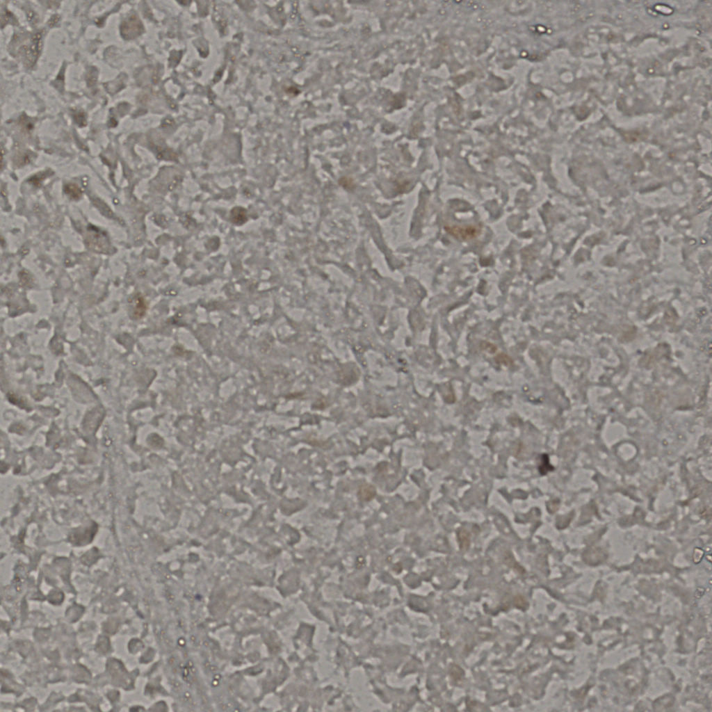 slice_19_38_x17024_y34048.png
