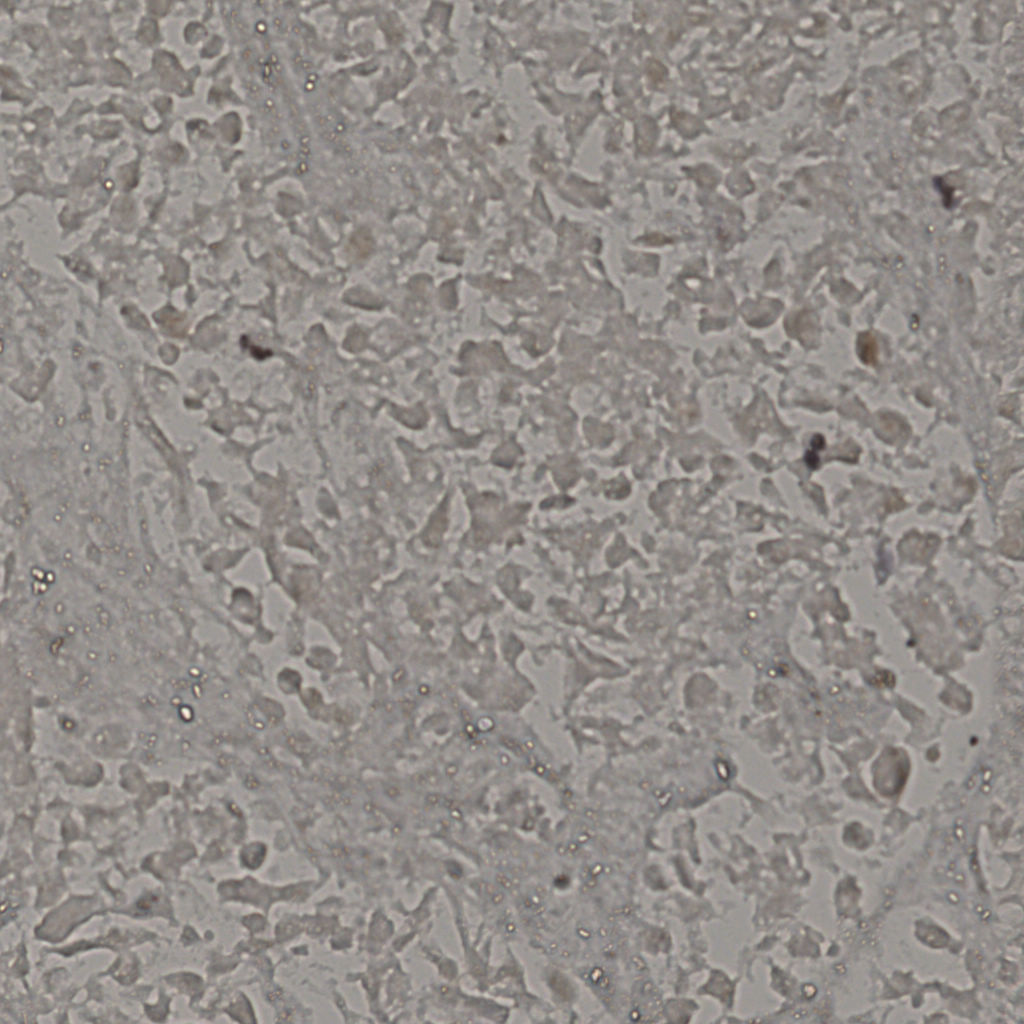 slice_19_39_x17024_y34944.png