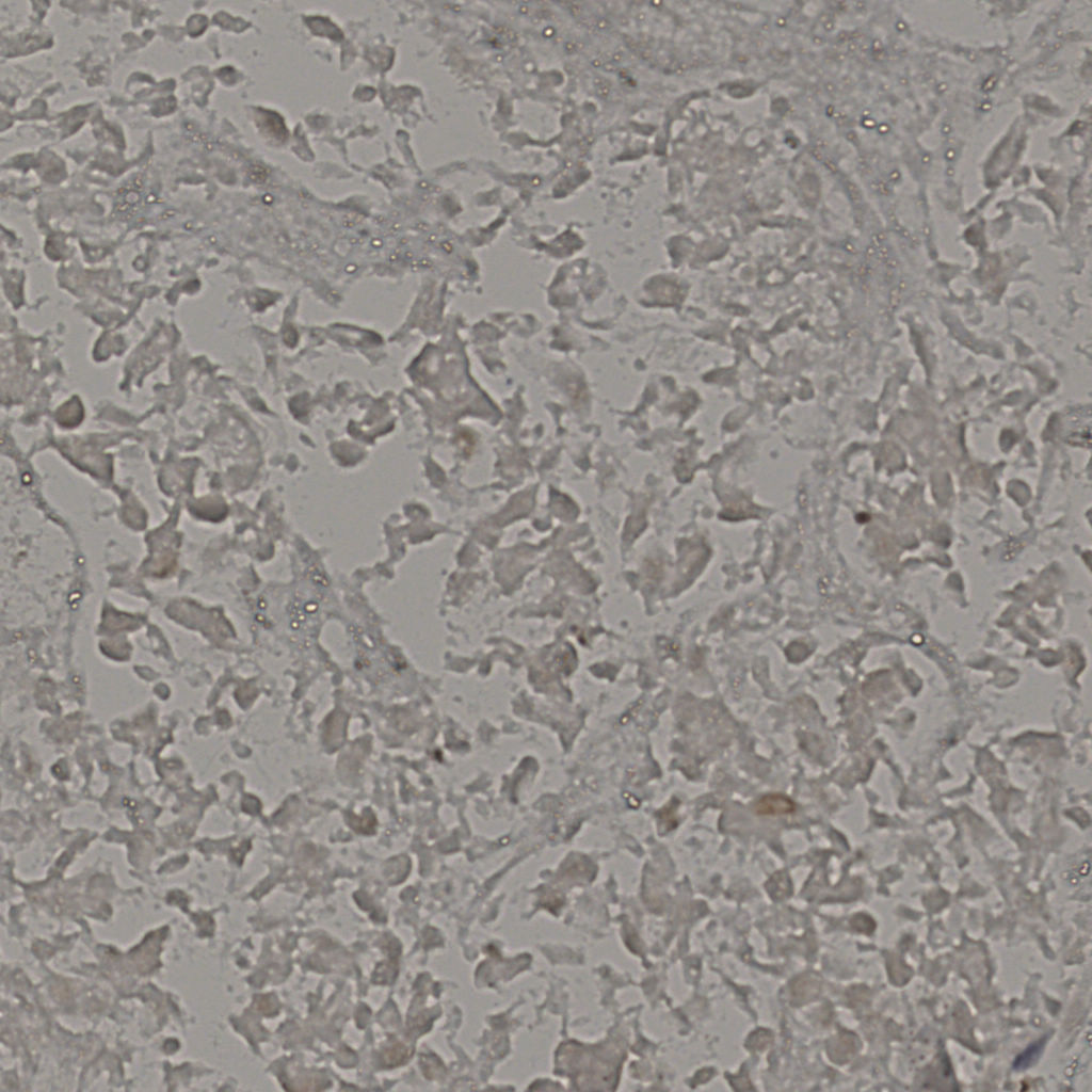 slice_19_41_x17024_y36736.png