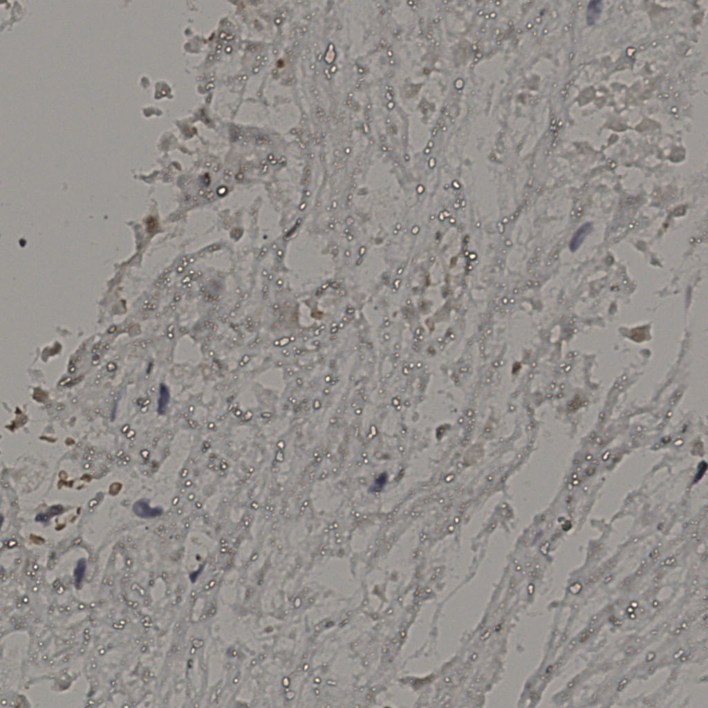 slice_19_43_x17024_y38528.png