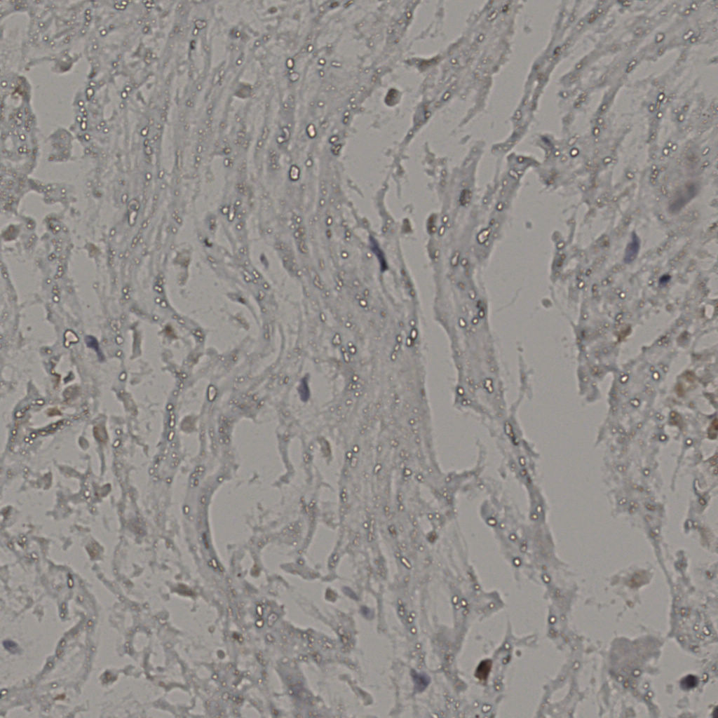 slice_19_44_x17024_y39424.png