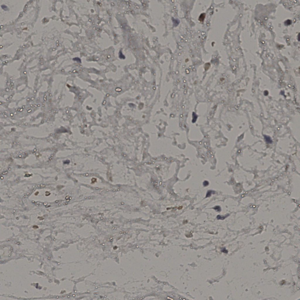 slice_19_45_x17024_y40320.png