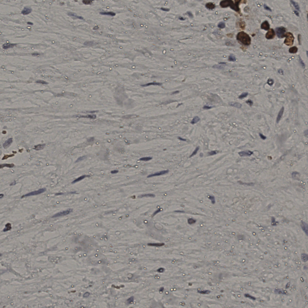 slice_19_50_x17024_y44800.png