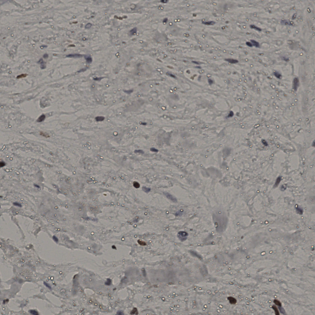 slice_19_51_x17024_y45696.png