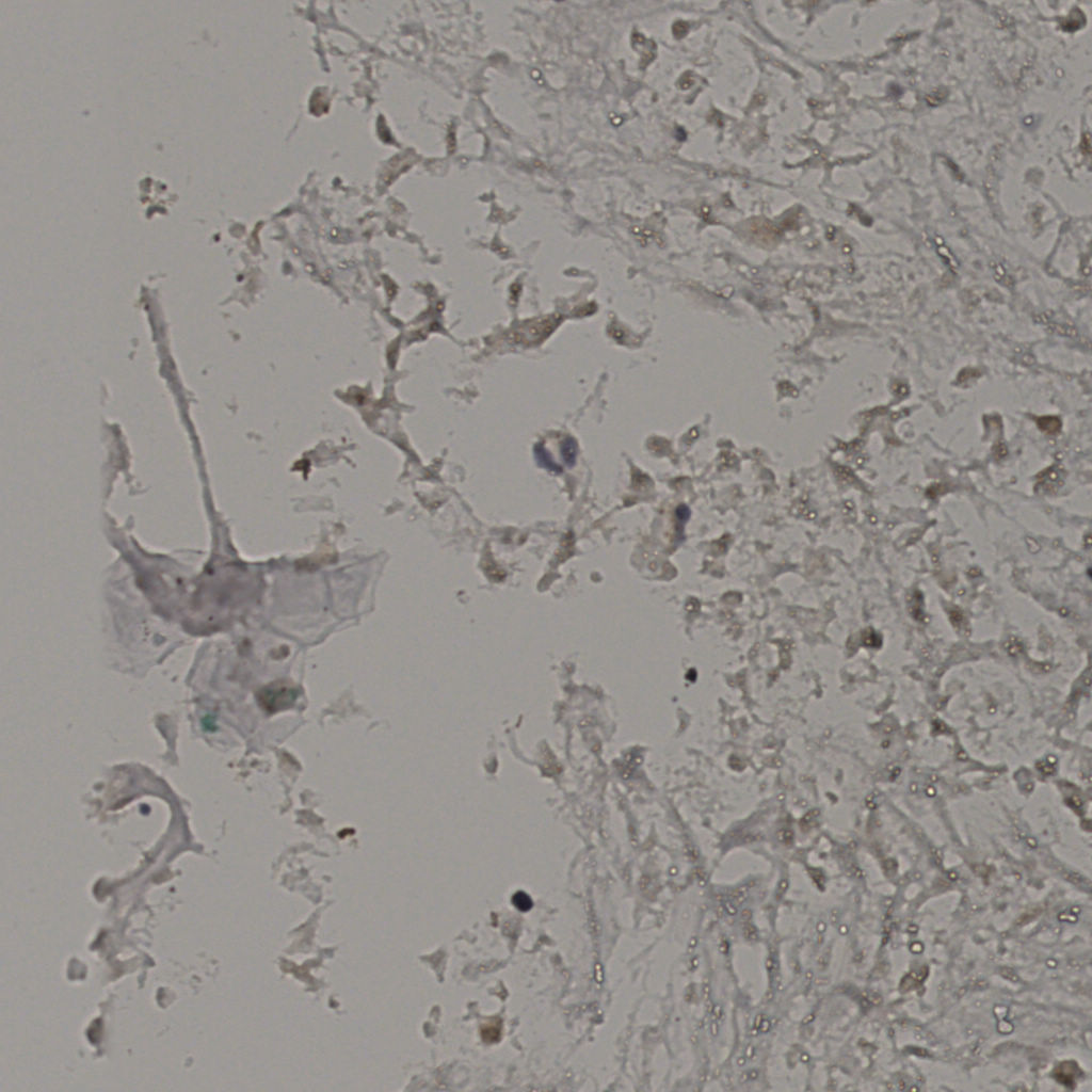 slice_20_32_x17920_y28672.png