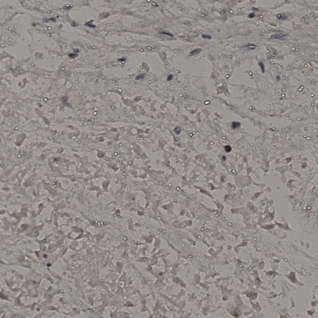 slice_20_36_x17920_y32256.png