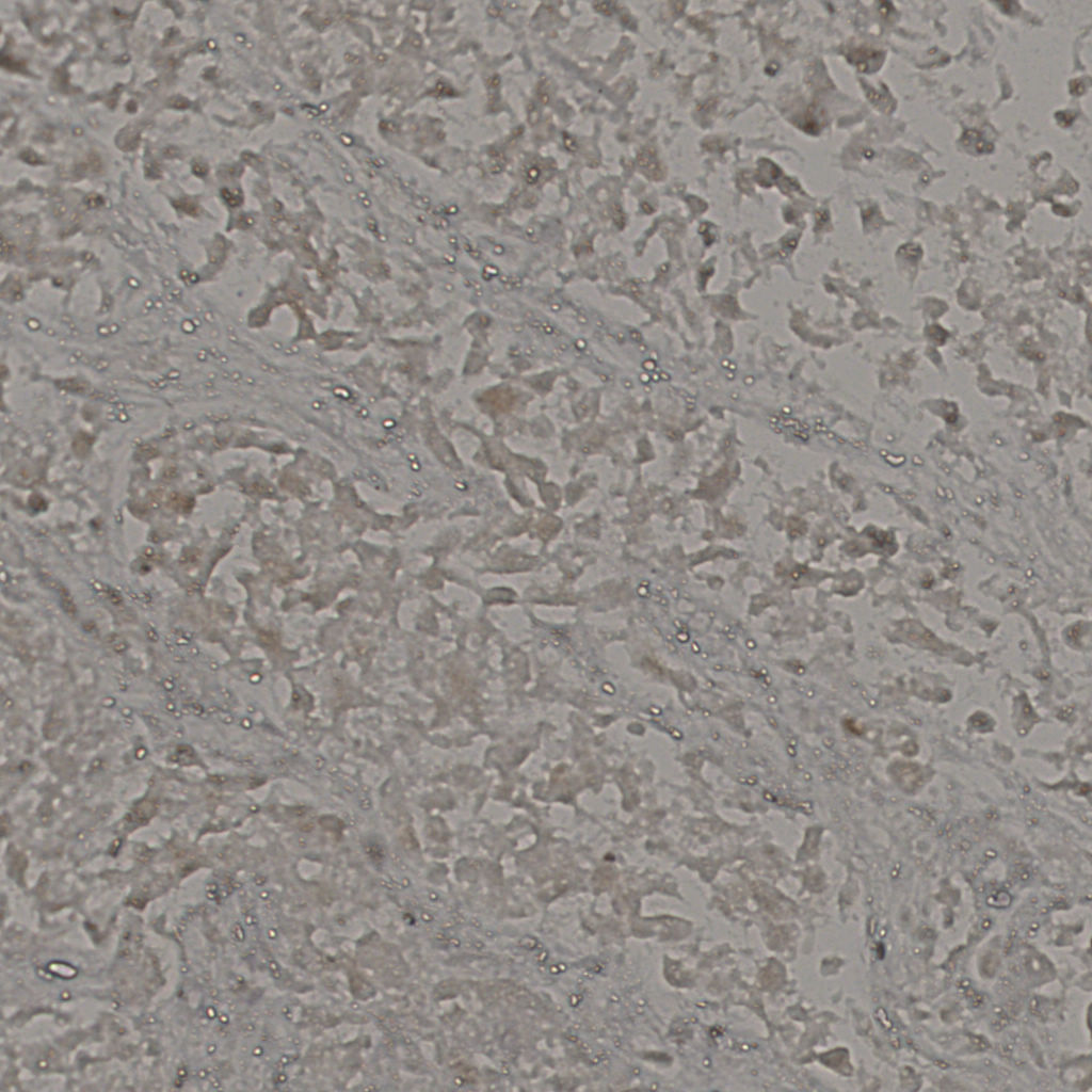 slice_20_37_x17920_y33152.png