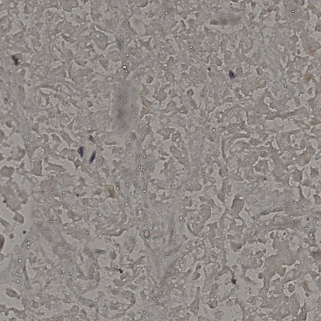 slice_20_39_x17920_y34944.png