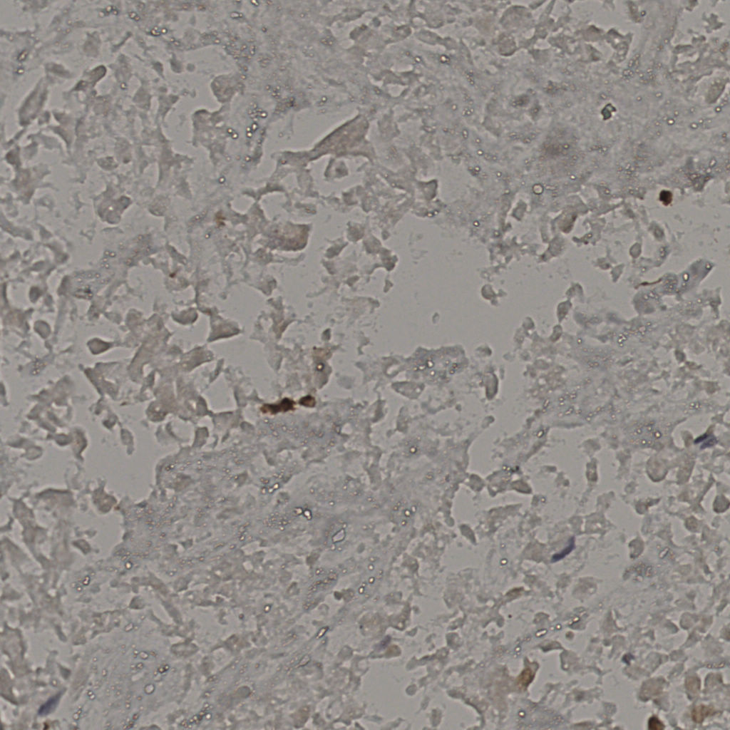 slice_20_41_x17920_y36736.png
