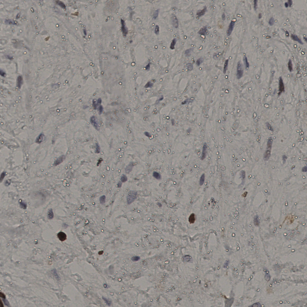 slice_20_51_x17920_y45696.png