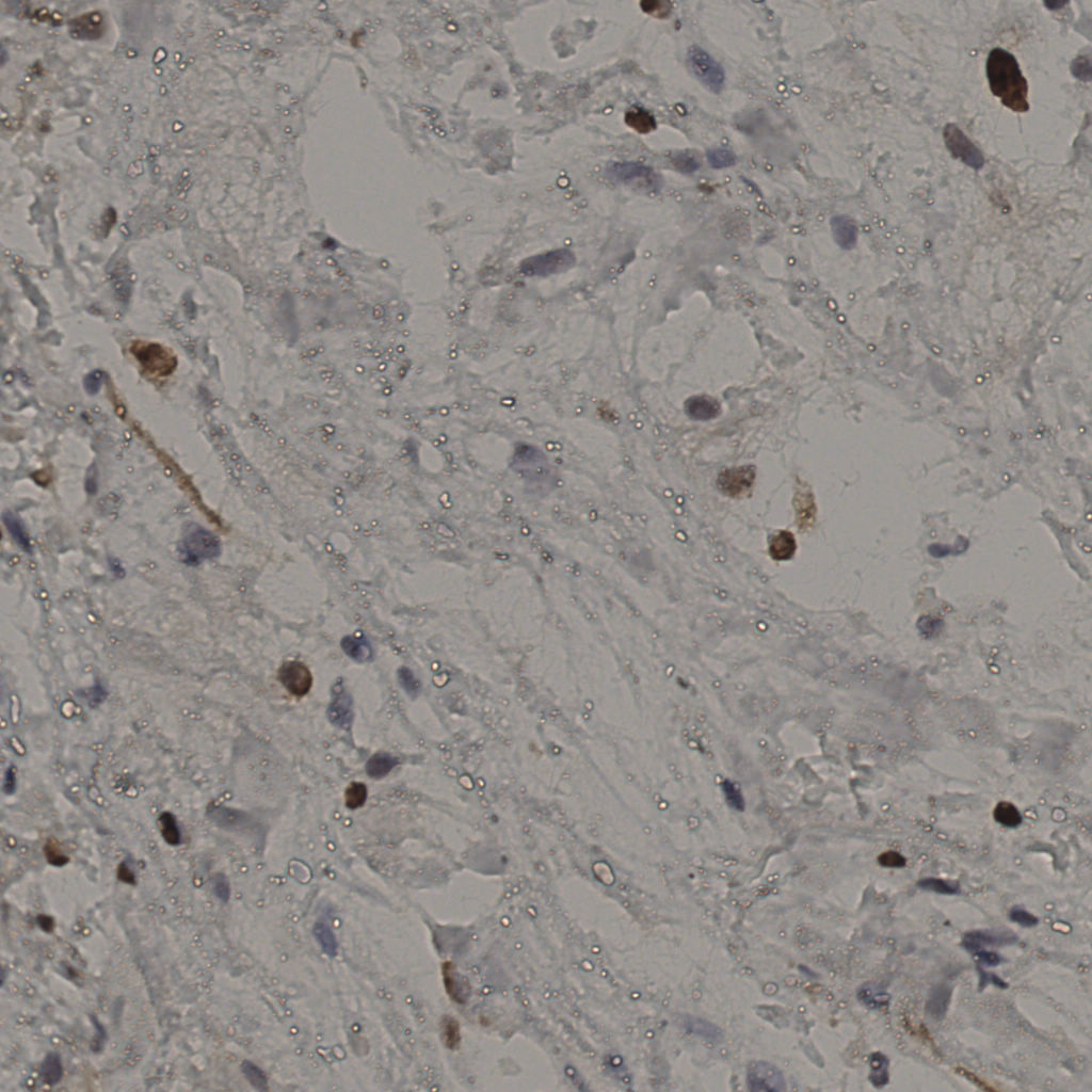 slice_20_53_x17920_y47488.png