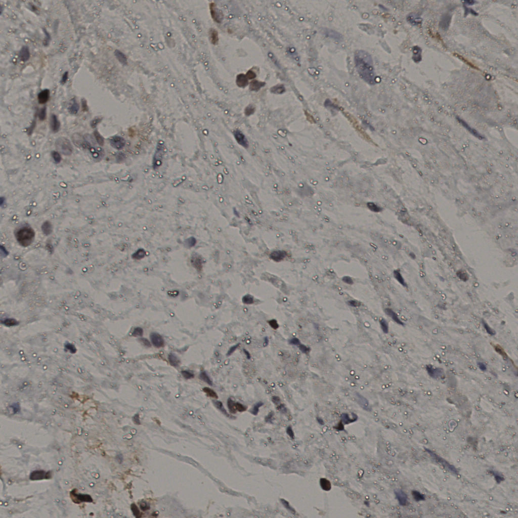 slice_20_54_x17920_y48384.png