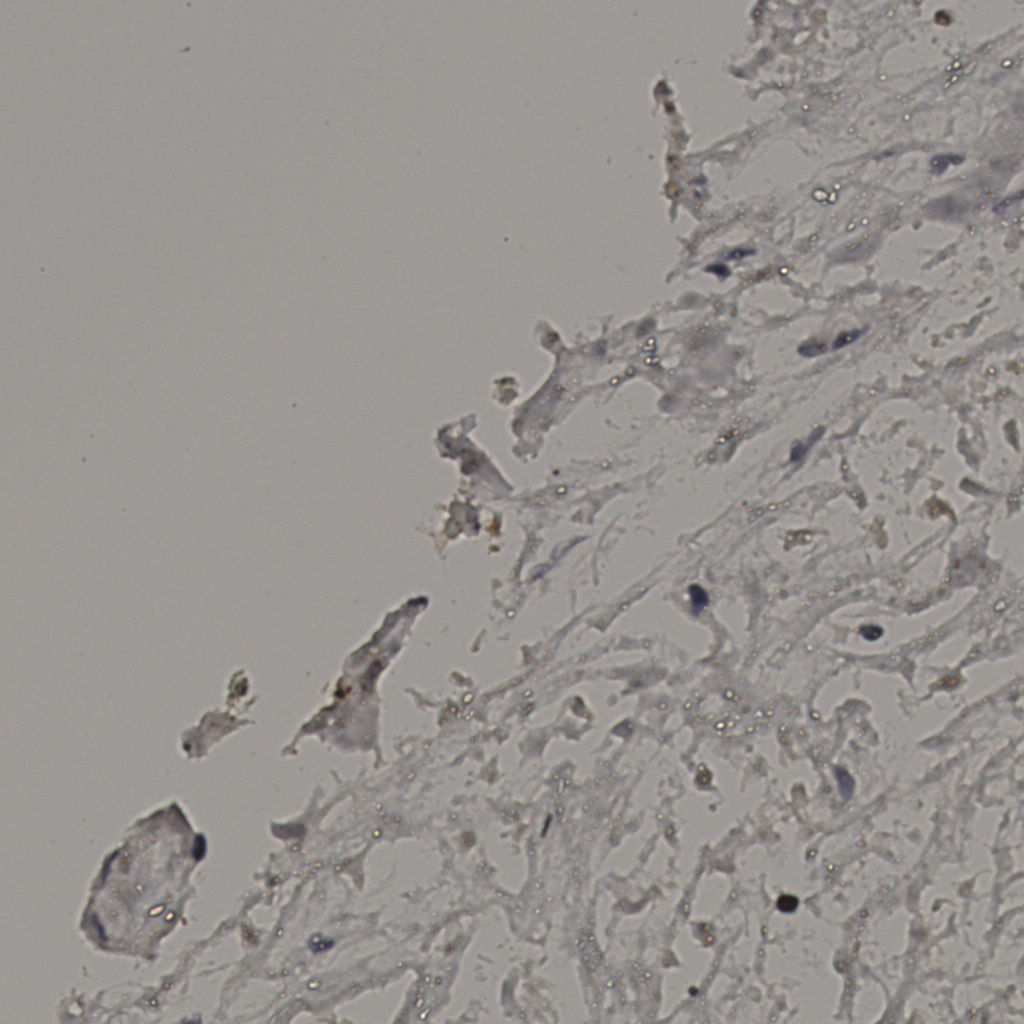 slice_21_29_x18816_y25984.png
