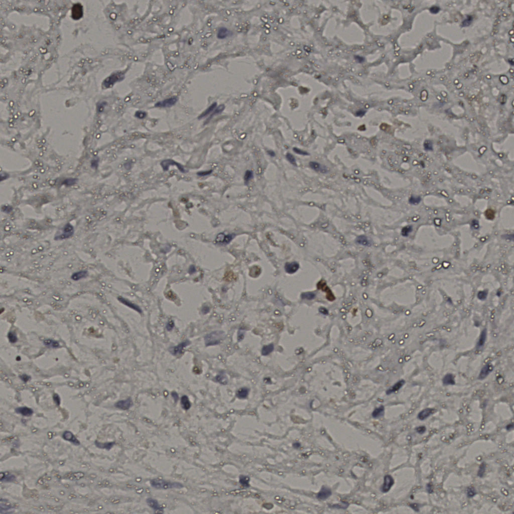 slice_21_35_x18816_y31360.png
