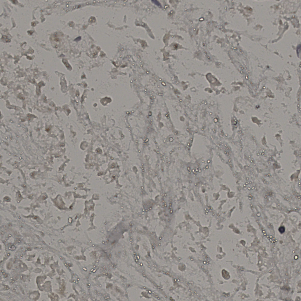 slice_21_37_x18816_y33152.png