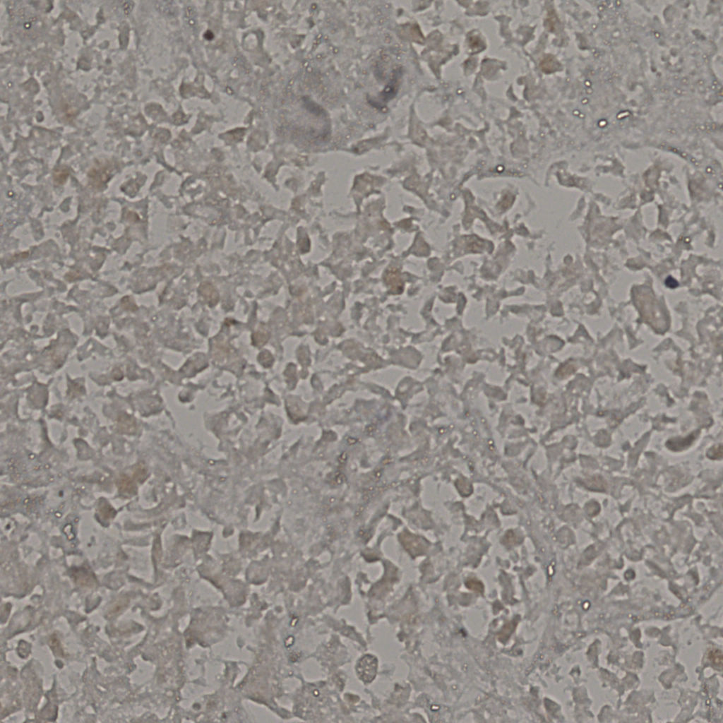slice_21_39_x18816_y34944.png