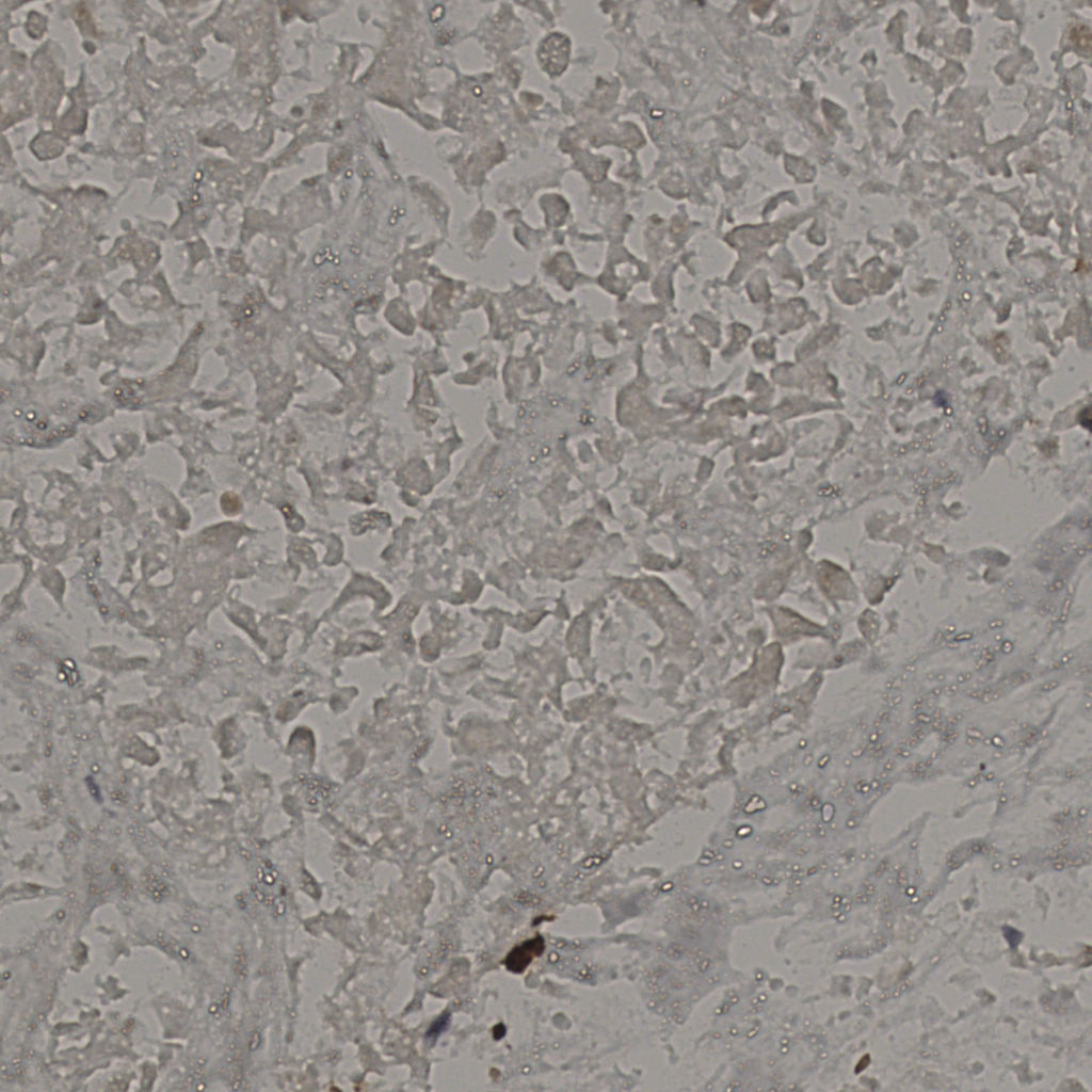 slice_21_40_x18816_y35840.png