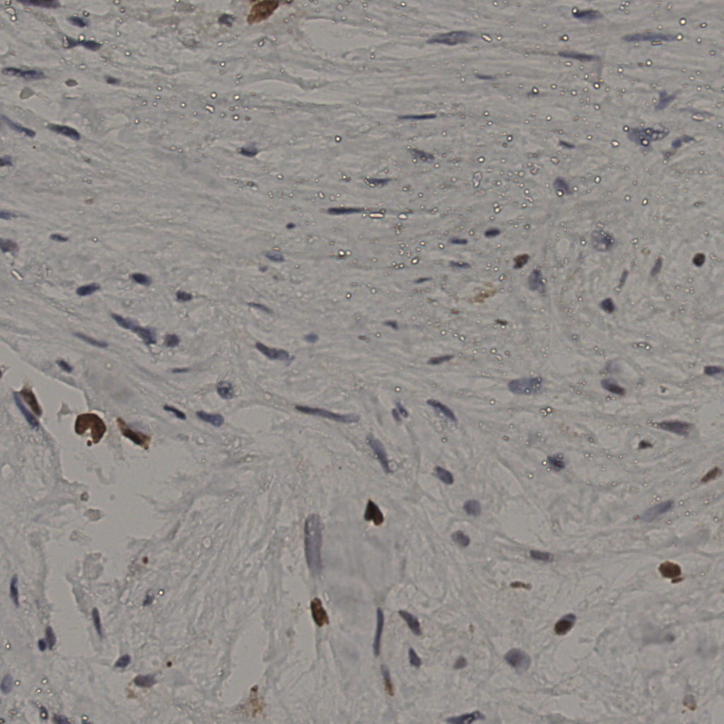 slice_21_50_x18816_y44800.png
