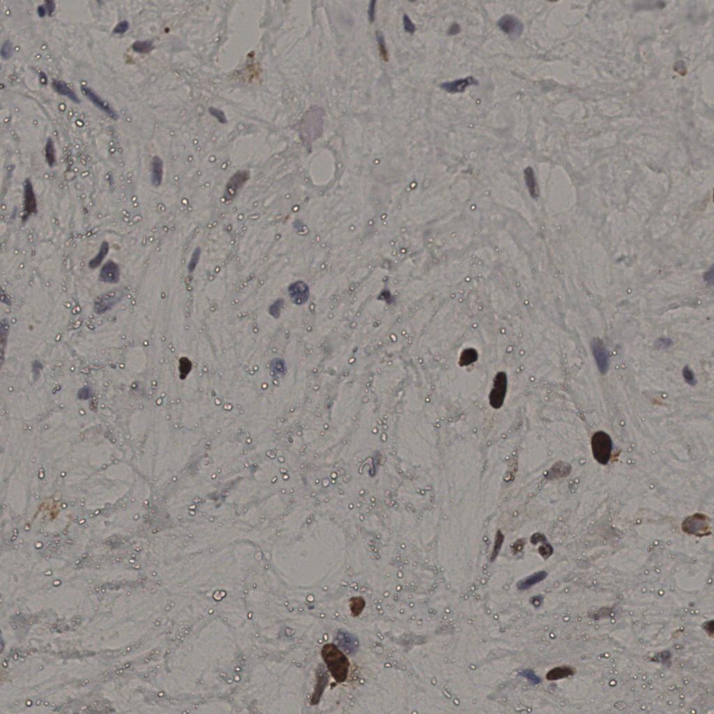 slice_21_51_x18816_y45696.png