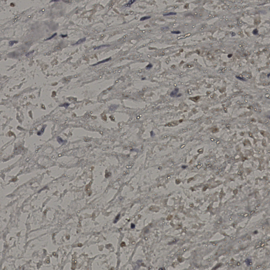 slice_22_29_x19712_y25984.png