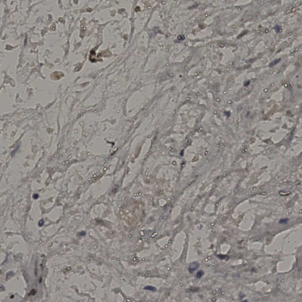 slice_22_30_x19712_y26880.png
