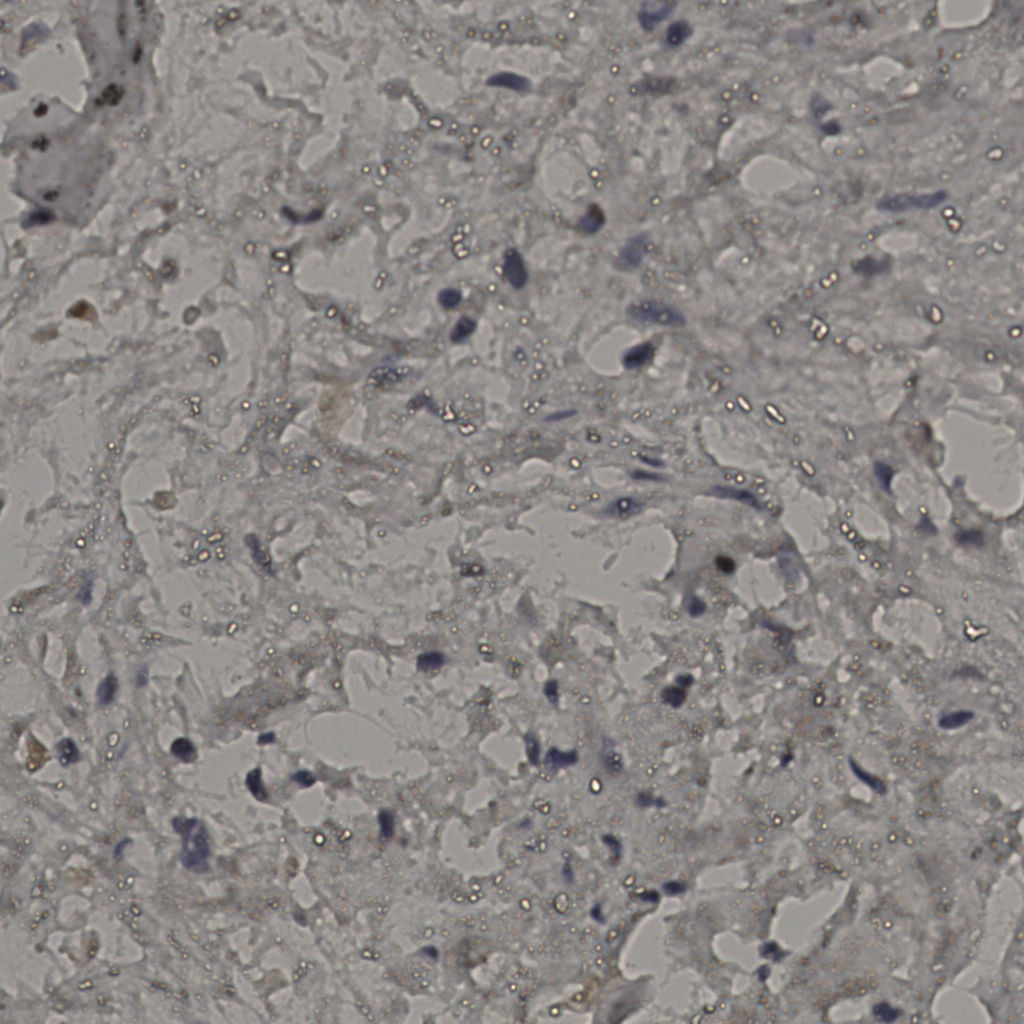 slice_22_31_x19712_y27776.png