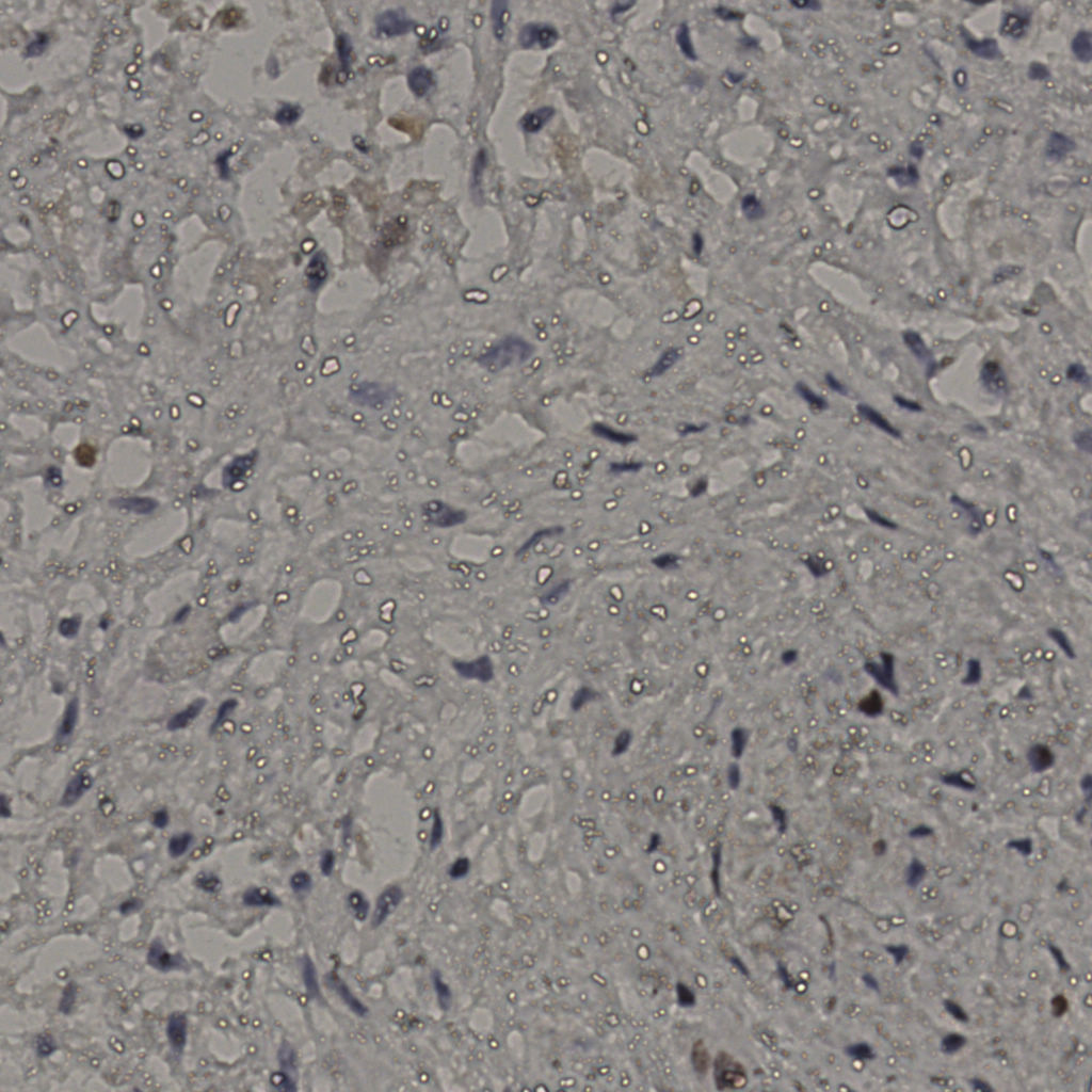 slice_22_35_x19712_y31360.png