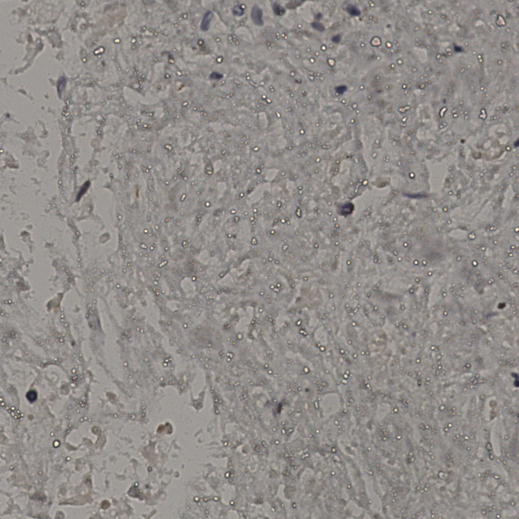 slice_22_37_x19712_y33152.png