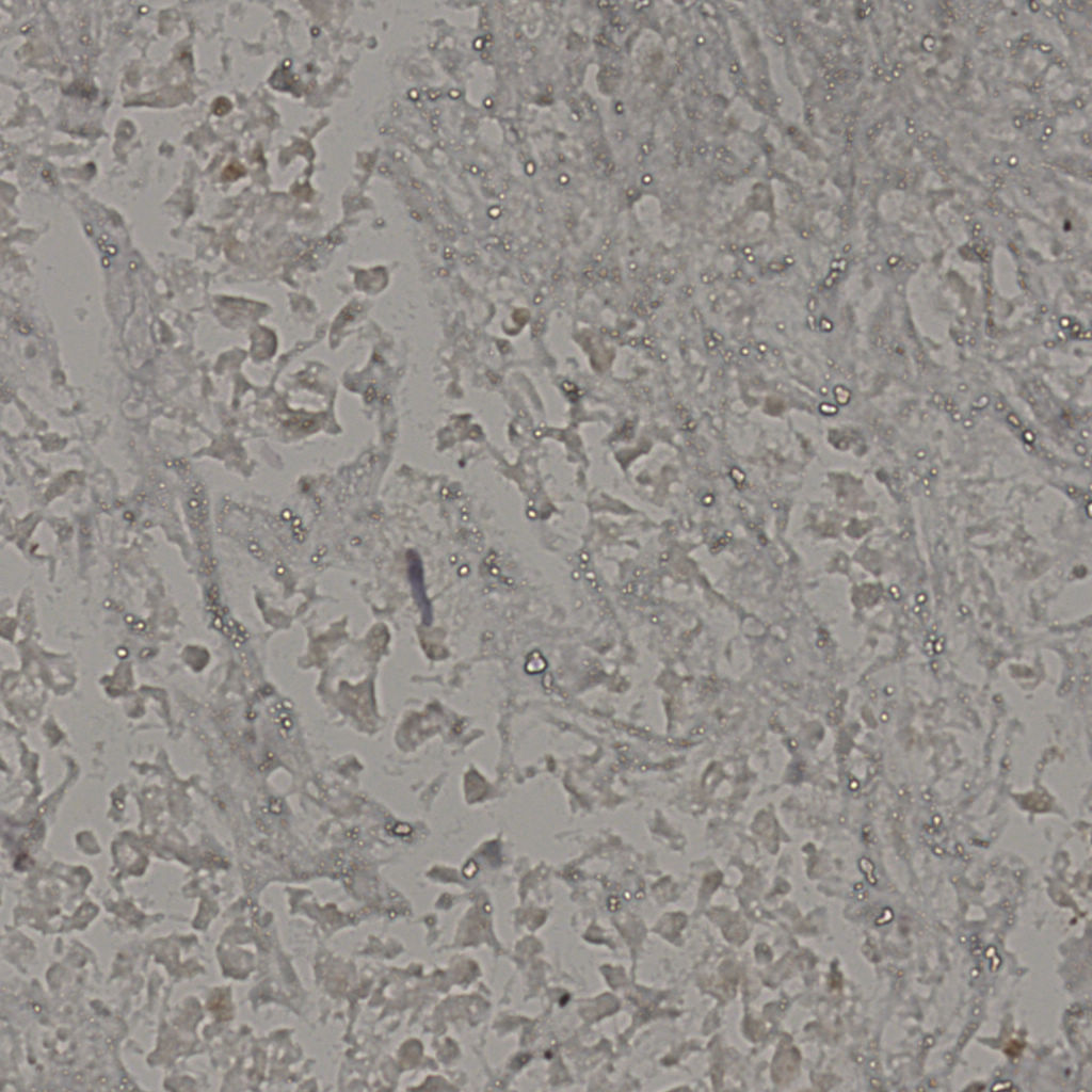 slice_22_38_x19712_y34048.png