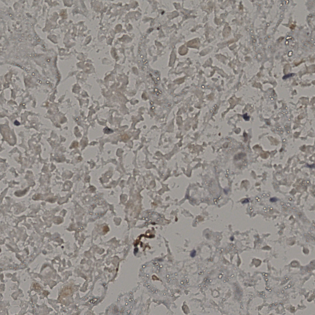 slice_22_39_x19712_y34944.png