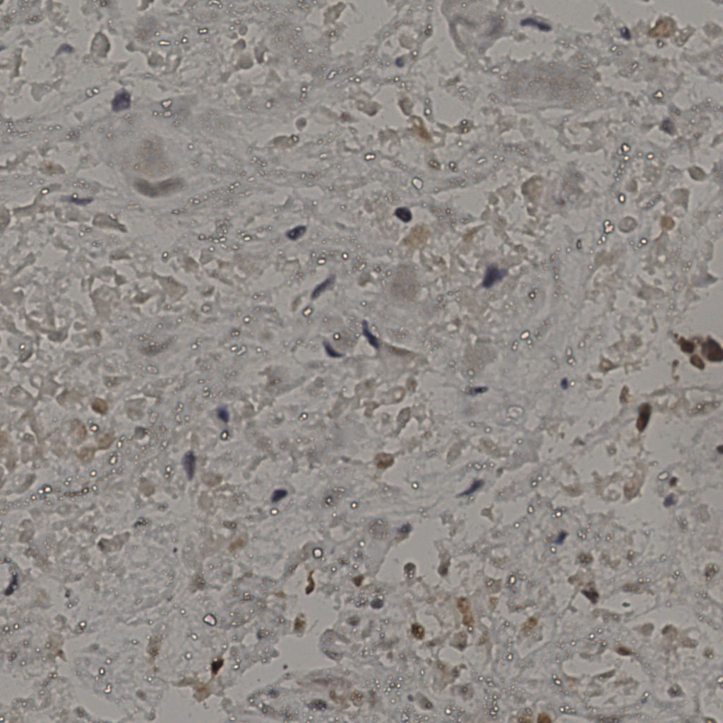 slice_22_42_x19712_y37632.png